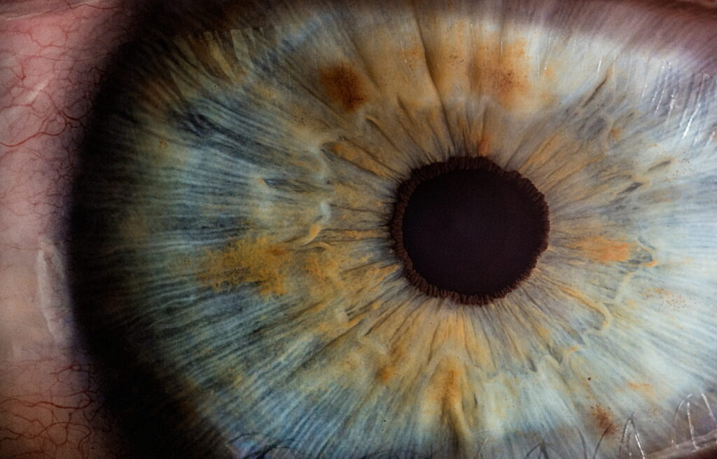 Pediatric Optometrist vs. Pediatric Ophthalmologist: Which Care Does Your Child Need?