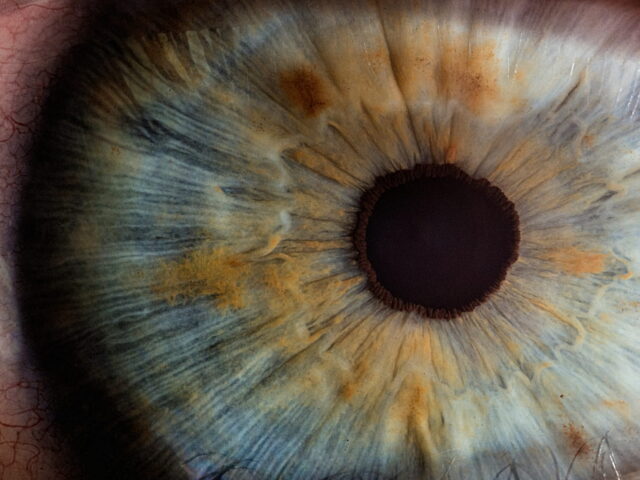 Pediatric Optometrist vs. Pediatric Ophthalmologist: Which Care Does Your Child Need?